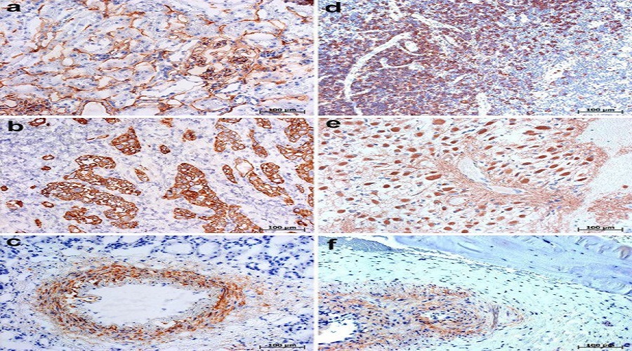 ihc-new-anatolyka