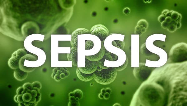 sepsis-new-anatolyka